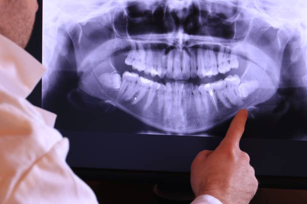 Best Broken or Cracked Tooth Emergency Dentist in St Georges, DE